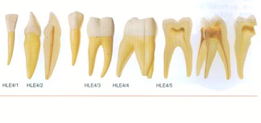 解剖教學模型|磨牙有兩個牙根模型