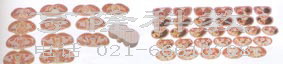 人體解剖模型|男性軀干斷層解剖橫切面模型