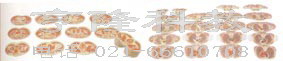 解剖教學模型|女性軀干斷層解剖橫切面模型