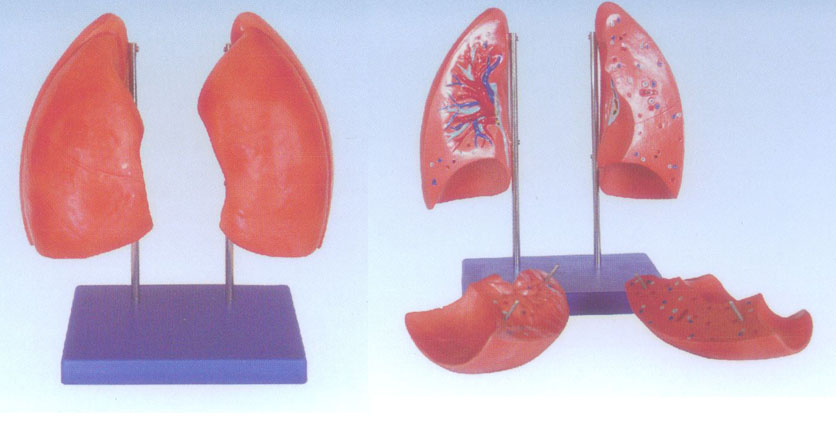 肺解剖模型