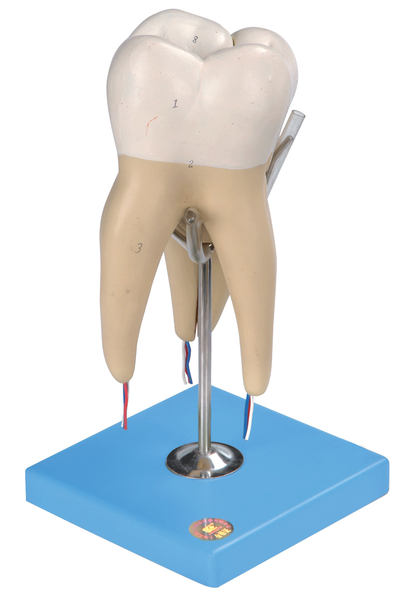 磨牙有三個牙根模型