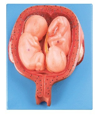 五個月雙胞胎模型